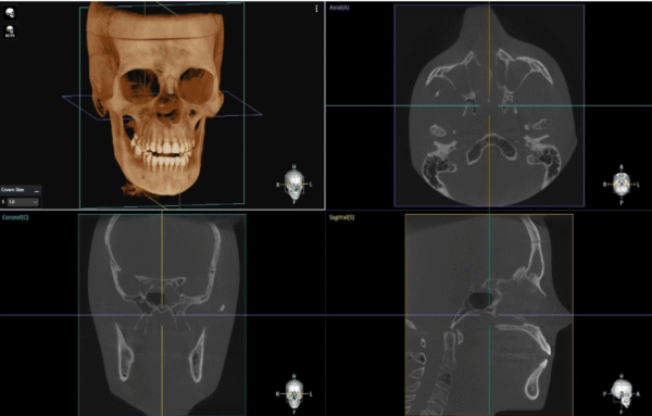 Dentium E-rainbow CT_R01-L 3IN1(CT+PANO+LINE CEPH)