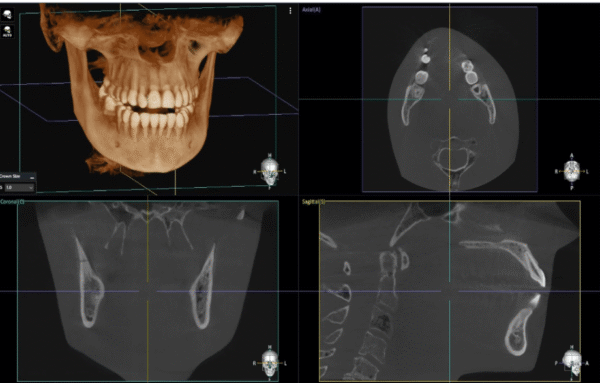 Dentium E-rainbow CT_R01-L 3IN1(CT+PANO+LINE CEPH)
