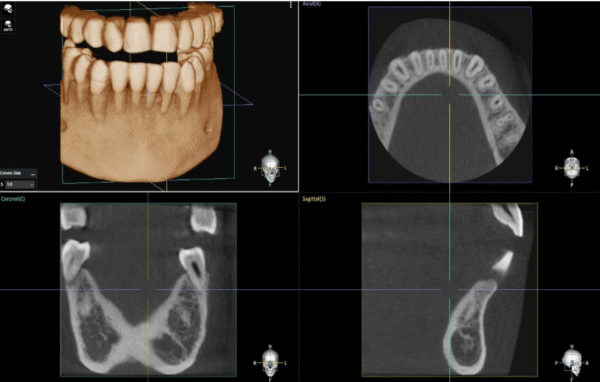 Dentium E-rainbow CT_R01-L 3IN1(CT+PANO+LINE CEPH)