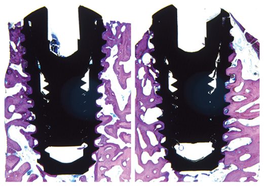 623cb84dabbcc2f8d8f26122_SLA-Human-Biopsy