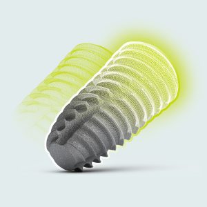 bright implants